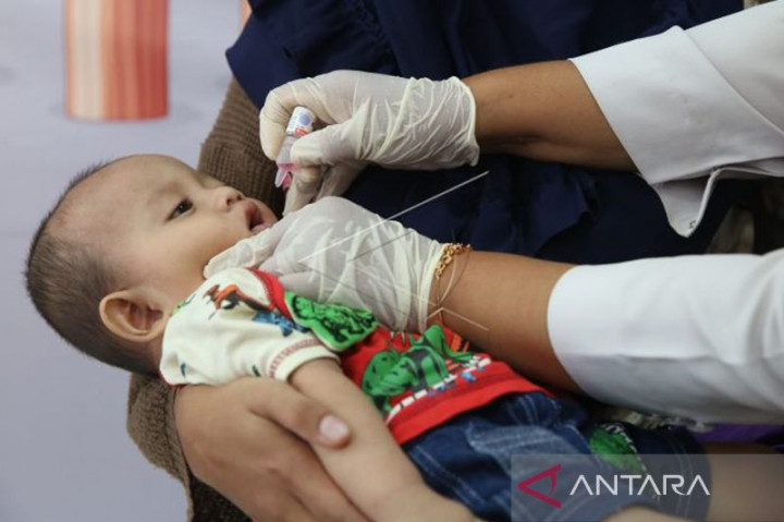 Dinkes Aceh Sebut Ada 4 Kasus Polio, 1 Jalani Terapi
