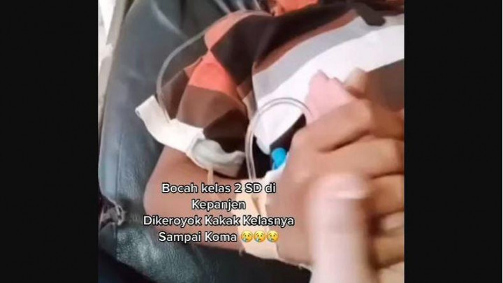 Bocah SD Korban Perundungan Kakak Kelas di Malang Jalani Operasi