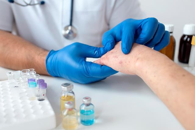 Monkeypox Berganti Nama menjadi 'Mpox' untuk Mengurangi Stigma