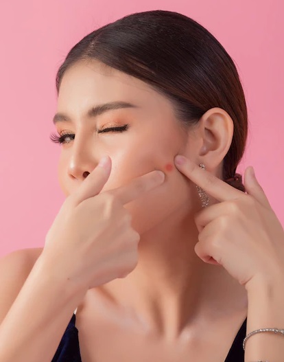 Jangan Lakukan 7 Hal ini pada Kulit, Menurut Ahli Dermatologi