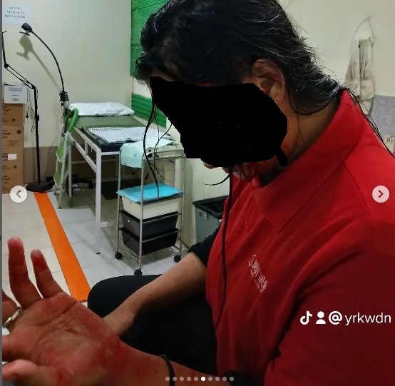 Viral, Wanita di Bekasi Babak Belur Bersimbah Darah Dianiaya Mantan Pacar