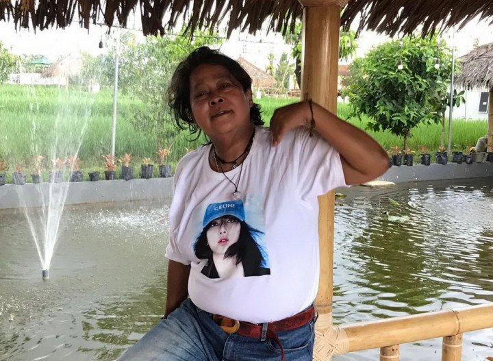 Amputasi Kaki Akibat Diabetes, Suti Karno: Saya yang Minta