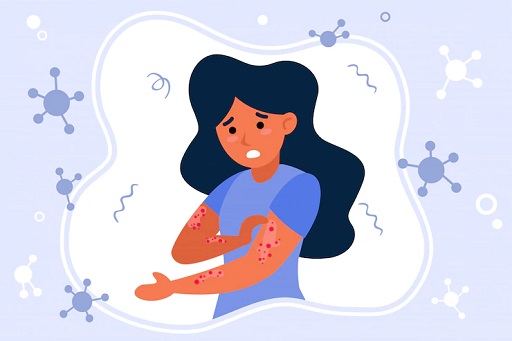 Gatal menjadi salah satu gejala panu yang paling mudah diketahui. (Foto: Ilustrasi. Dok. Freepik.com)