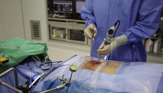 Mengenal Biportal Endoscopic Spinal Surgery