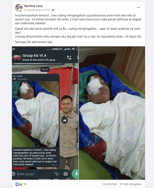 [Cek Fakta] Foto Anak SD Main Lato-Lato Hingga Bola Mata Pecah? Cek Faktanya.