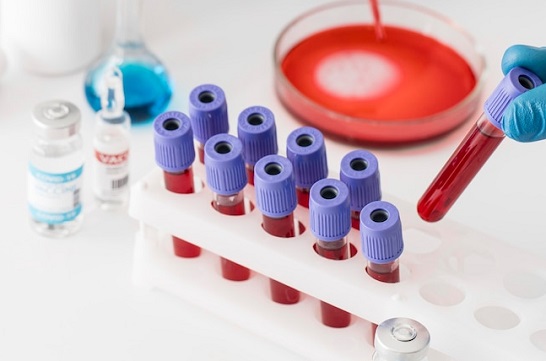 Fungsi albumin untuk mengatur tekanan osmotic darah, menjaga keberadaan air dalam plasma darah sehingga bisa mempertahankan volume darah. Ilustrasi: Freepik