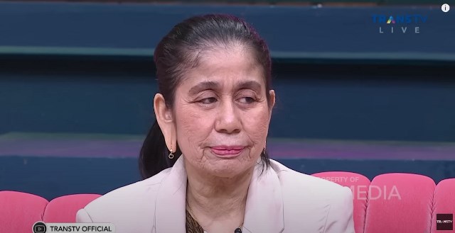 Puspa Sari Dewi Alami Sindrom Progeria, Apakah Itu?