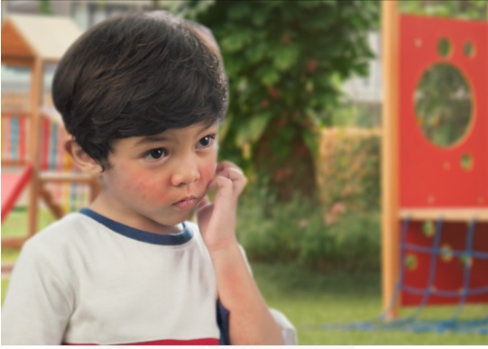 Anakmu Alergi Susu Sapi? Ini Alternatifnya Menurut Pakar