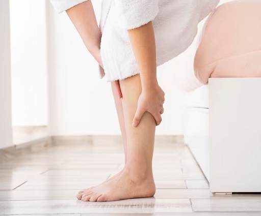 Waspada, Kebiasaan Tidak Sehat Ini dapat Meningkatkan Risiko Varises