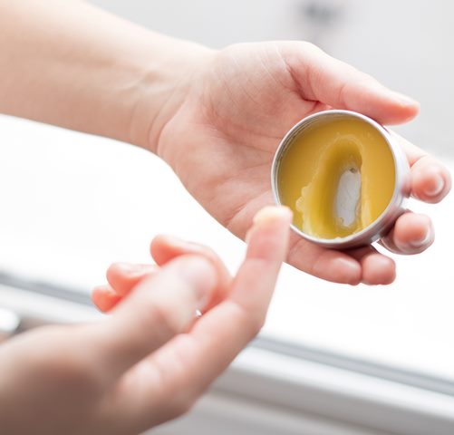 Sontek cara mempercepat hilangkan luka koreng yang hitam. (Foto: Ilustrasi/Dok. Unsplash.com)