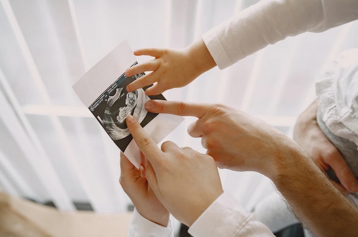 Cara Menentukan Jenis Kelamin Janin sebelum Kehamilan