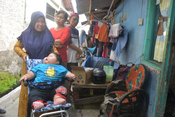 Biaya Penanganan Balita Obesitas di Bekasi Ditanggung Pemkab