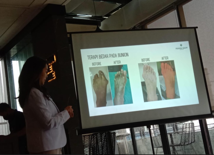 dr. Astuti Pitarini, Sp. Ot (K) sedang memaparkan penyakit bunion. (Foto: Nandhita/Medcom)