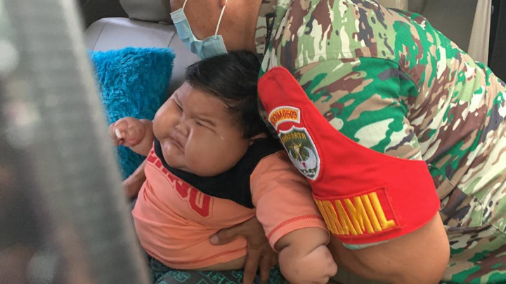 Tim Dokter dari 10 Disiplin Ilmu di RSCM Akan Tangani Bayi Obesitas dari Bekasi