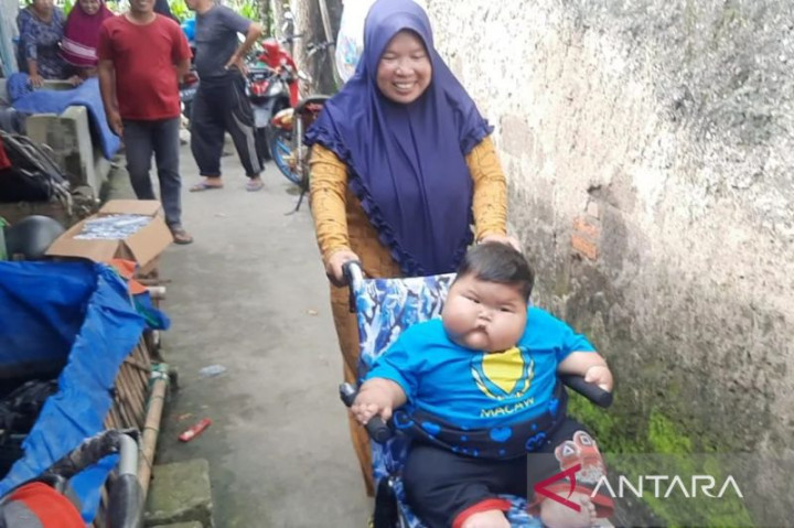 Pemkab Bekasi Siapkan Bantuan bagi Balita Obesitas