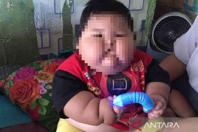 Balita obesitas Muhammad Kenzi Alfaro asal Kampung Tambun Permata, RT 002/002, Desa Pusaka Rakyat, Kecamatan Tarumajaya, Kabupaten Bekasi, Jawa Barat. (ANTARA/Pradita Kurniawan Syah).