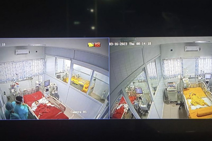 Operasi Bayi Kembar Siam di RSUDAM Lampung Berhasil