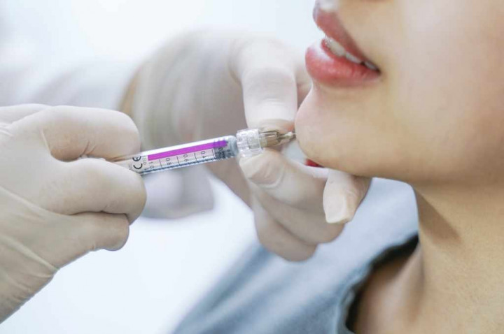 Hati hati! Ini Risiko jika Terima Treatment Filler oleh Tenaga Medis Non-Dokter