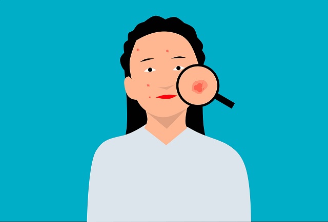 Ilustrasi: Pixabay