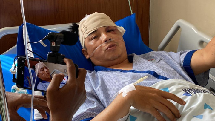 Korban Luka Berat Kecelakaan Mobil Dinas Bupati Kuningan Masih Dirawat Intensif