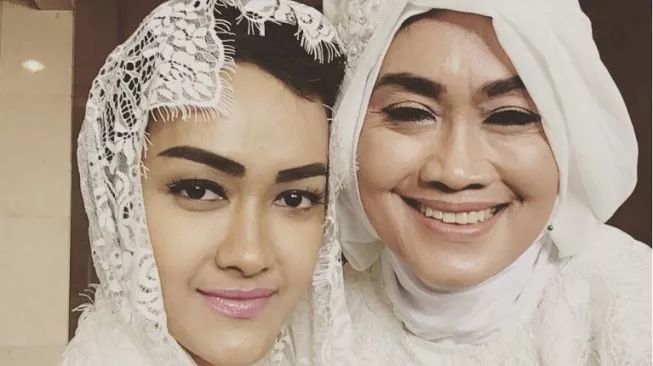 Kronologi Ibunda Julia Perez Ditabrak Hingga Alami Pendarahan Otak