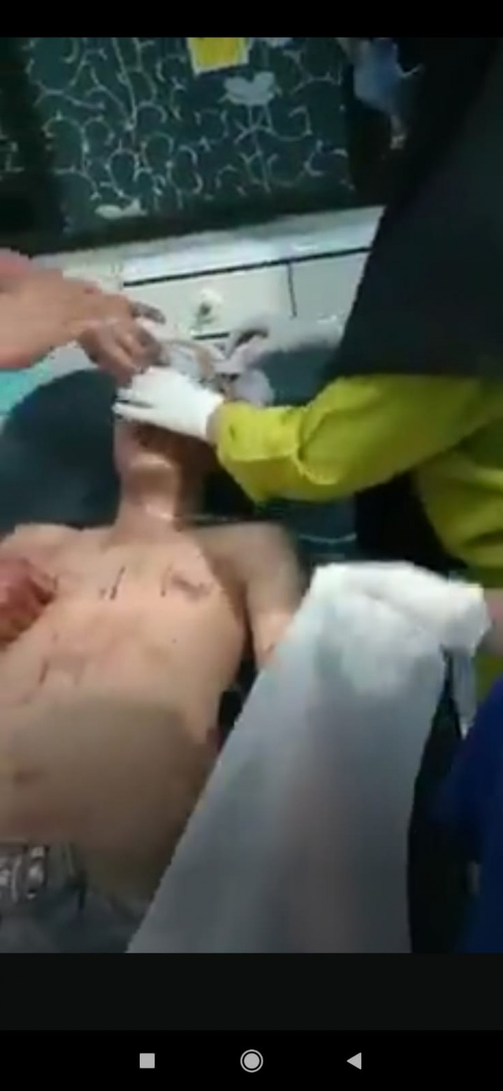 Viral! 4 Pria Saling Bacok di Rumah Istri Siri di Pujon Malang