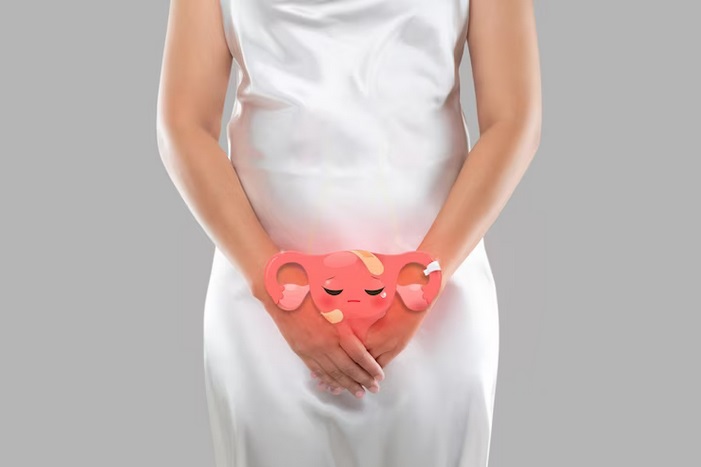 Ladies, Ini Cara Mengatasi Kutil Kelamin di Miss V