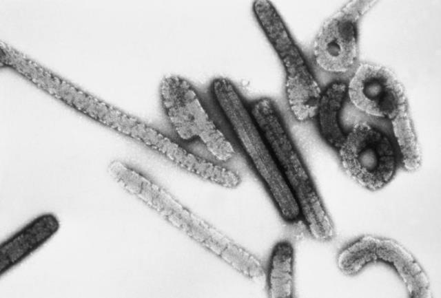 Penampakan virus margburg. (Foto: Dok. CDC)