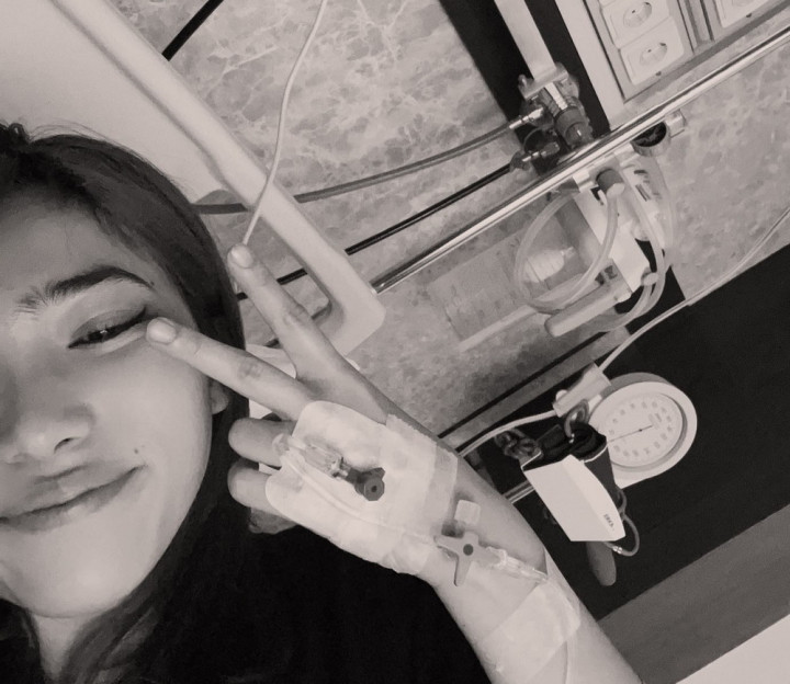 Isyana Sarasvati Idap Penyakit Lupus