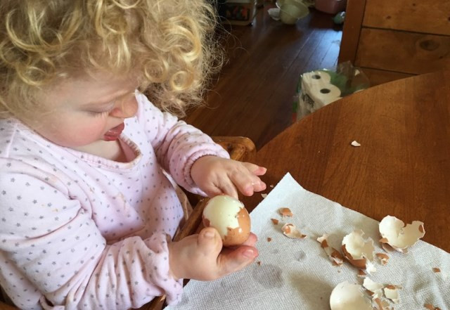 Sindrom Apert, Kenali Gejala dan Penanganannya