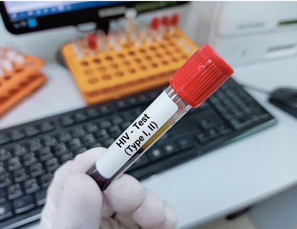 Kasus HIV Pada Ibu Rumah Tangga Naik 35 Persen, Ketahui Penyebabnya