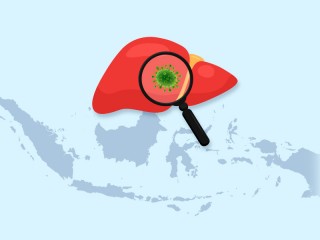 Ilustrasi hepatitis/Istimewa