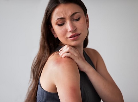 Meski tidak menular, namun dermatitis atopik akan dibawa seumur hidup. (Foto: Ilustrasi. Dok. Freepik.com)