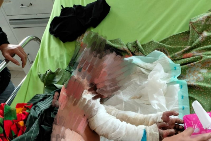 4 Warga Rejang Lebong Tersambar Api Ledakan Tabung Gas