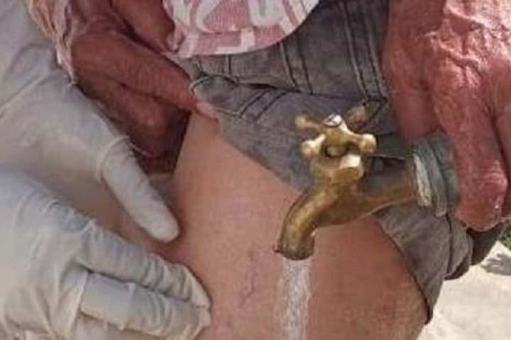 Dinkes Manggarai Minta Puskesmas Perkuat Pendataan Kasus Rabies