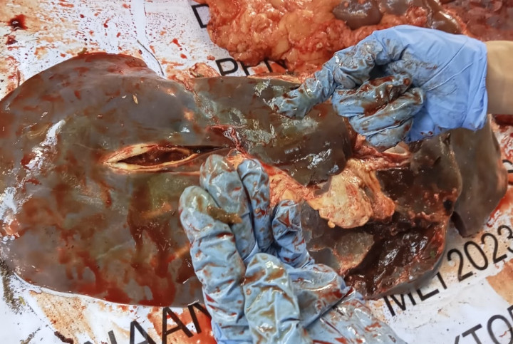 Cacing Hati Ditemukan pada 3 Sapi di Jepara, Daging Dilarang Dibagikan