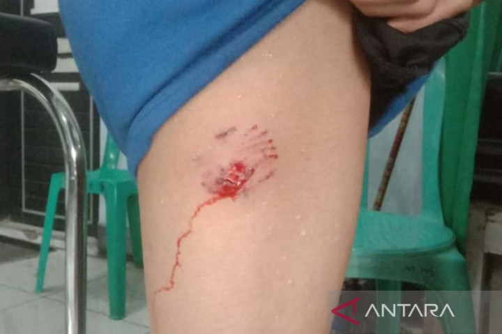 Bertambah 1, Korban Tewas Gigitan Anjing Rabies di TTS jadi 6 Orang