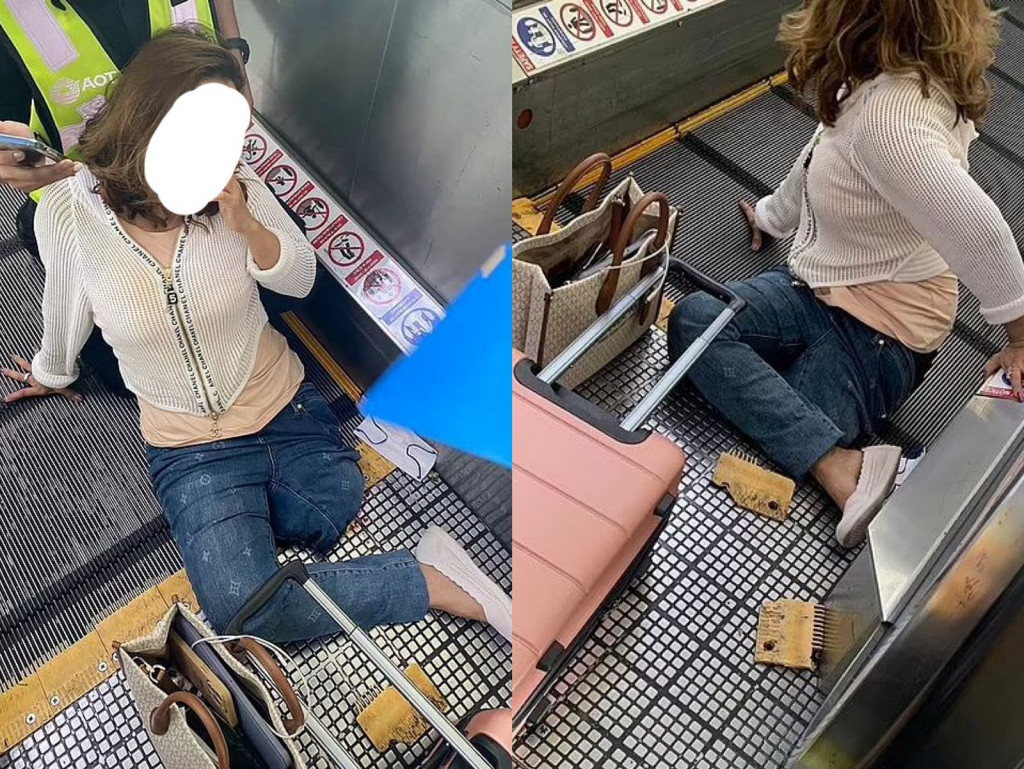 Kaki seorang perempuan harus diamputasi akibat terjepit eskalator bandara di Bangkok, foto: Dailymail