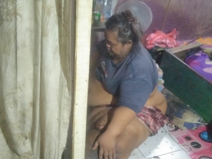 Pria 45 Tahun di Tangerang Alami Obesitas hingga Berat 200 Kg