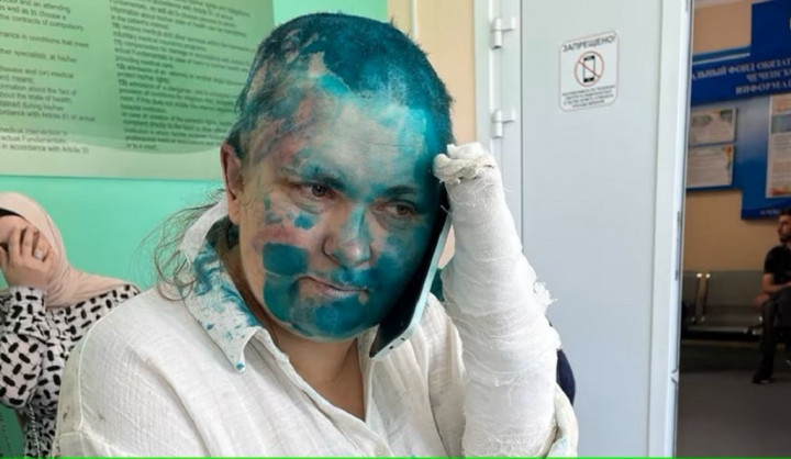 Duh, Jurnalis Rusia Dipukuli hingga Jarinya Patah di Chechnya