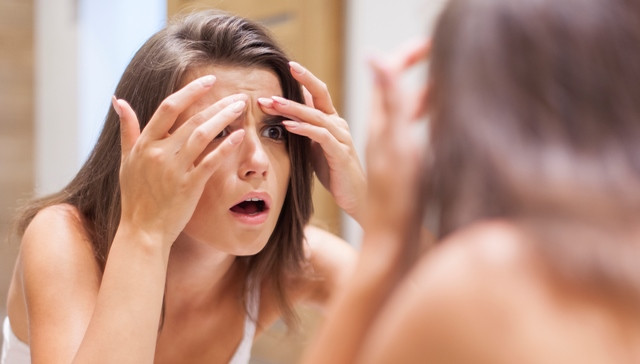 Ladies, Kenali Penyebab Jerawat Berdasarkan Letaknya, Yuk!