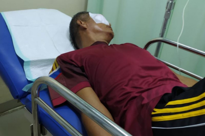 Tegur Siswa yang Merokok, Guru SMA Hampir Buta Dianiaya Wali Murid