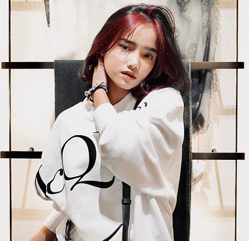 Curhat di Medsos, Fuji Bagikan Rontgen Dirinya Alami Skoliosis