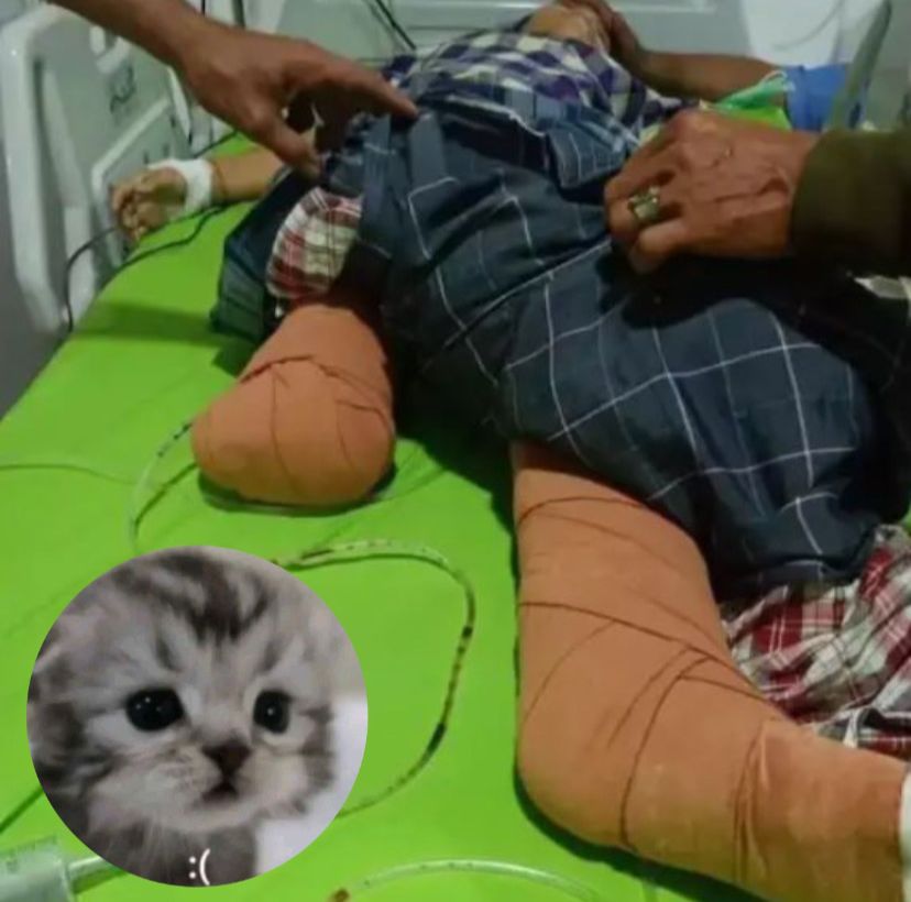 Kaki anak SD diamputasi akibat kecelakaan truk demi selamatkan kucing, foto: INSTAGRAM/nenktainment