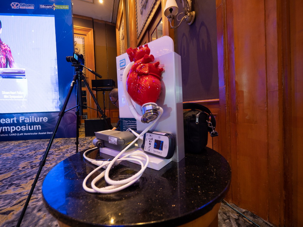 Mengenal Alat LVAD untuk Penderita Gagal Jantung (foto: ist)
