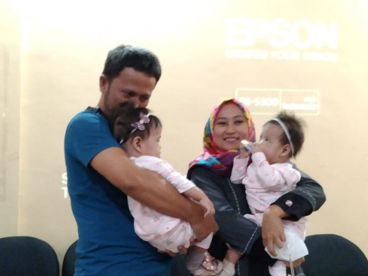 Orang Tua Kembar Siam Bersyukur Aisyah Aliyah Bisa Terpisah