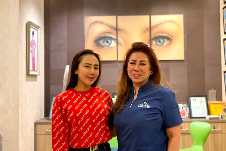 Ucie Sucita Makin Pede Usai Jalani Transplantasi Rambut