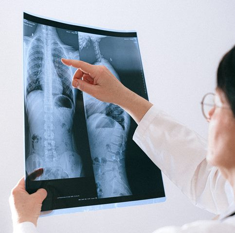 Dokter memaparkan soal hidup dengan satu paru-paru. (Foto: Ilustrasi/Dok. Unsplash.com)