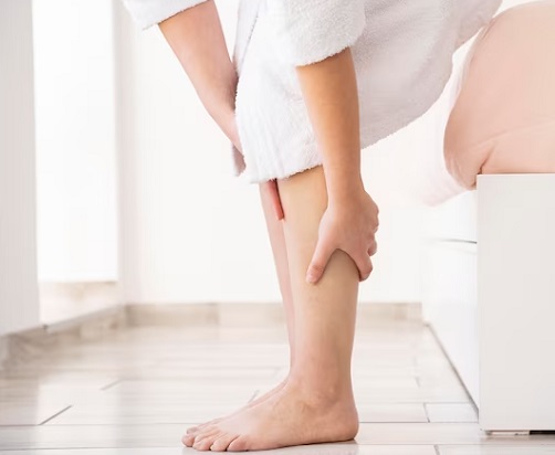 Punya Varises? Begini 5 Cara untuk Menyembuhkannya Secara Efektif