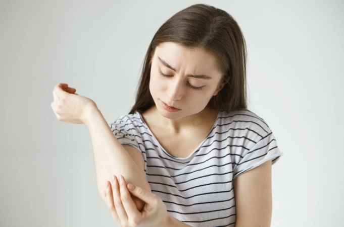 Jangan Salah Terka, Ini Perbedaan Panu dengan Kusta